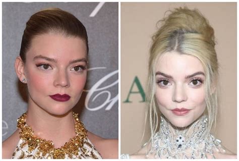 anya taylor-joy teeth|Anya Taylor Joy before surgeries : r/trueratecelebrities。